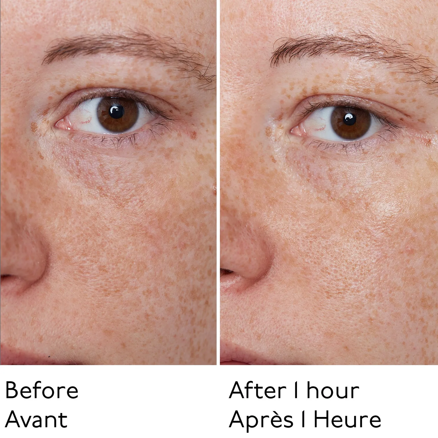 By Terry Hyaluronic Global crème visage 8 acides hyaluroniques