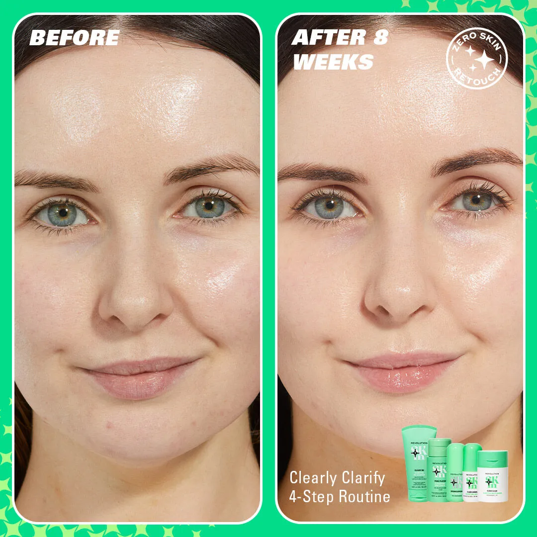Revolution Skin Clearly Clarify kit 4 soins anti-boutons