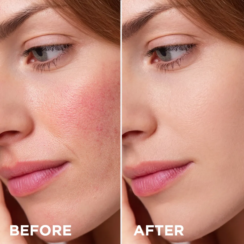 Eveline Magic Skin CC crème anti-rougeurs hydratante teinte neutre