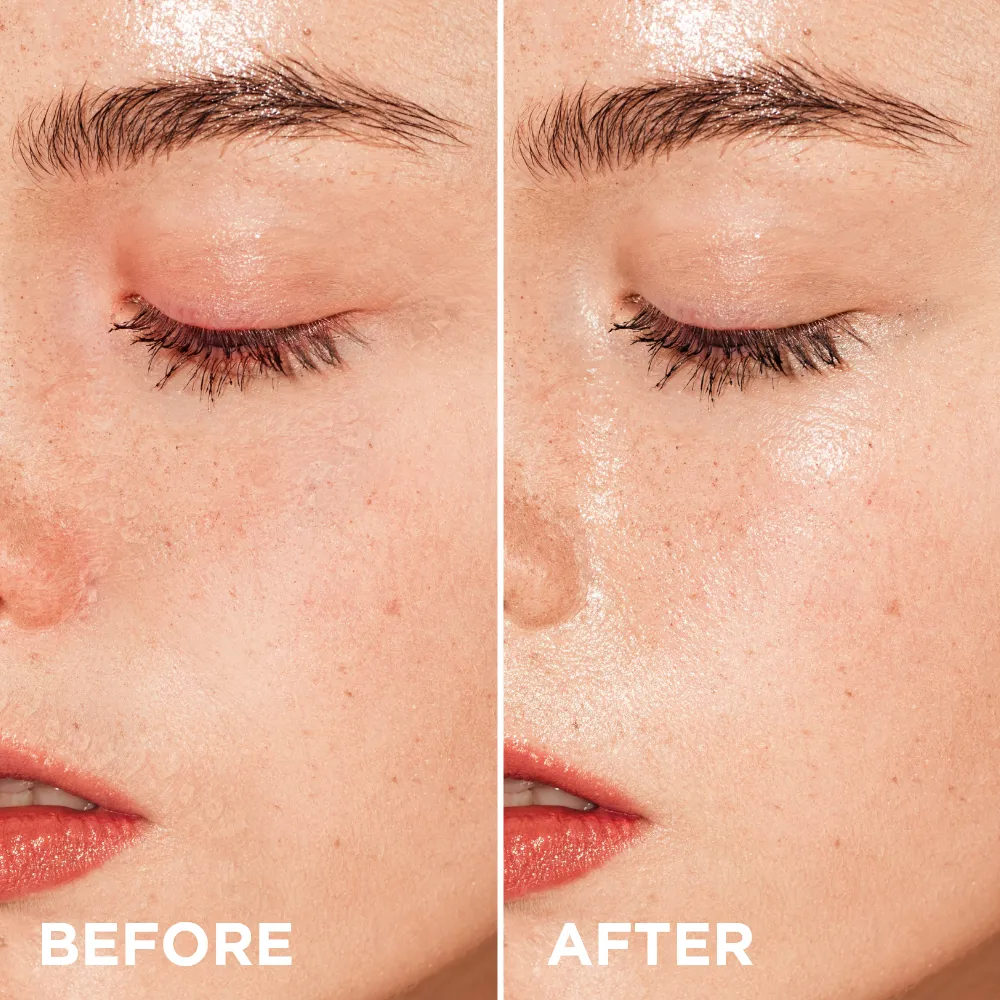 Eveline MesoNeedles crème visage hyaluronique hydratante