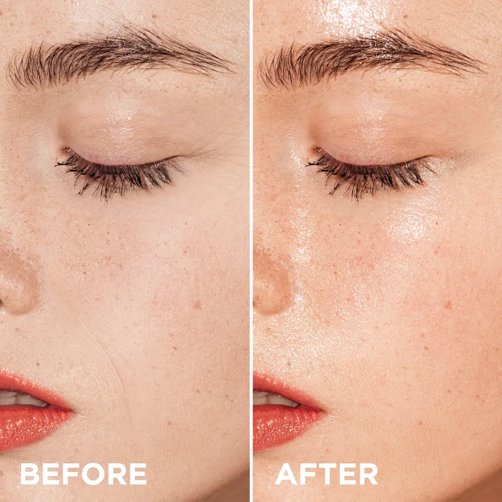 Eveline MesoNeedles méso-crème vitaminée nourrissante