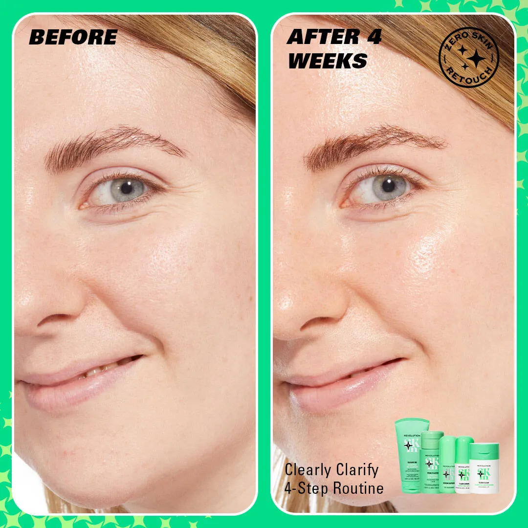 Revolution Skin Clearly Clarify kit 4 soins anti-boutons
