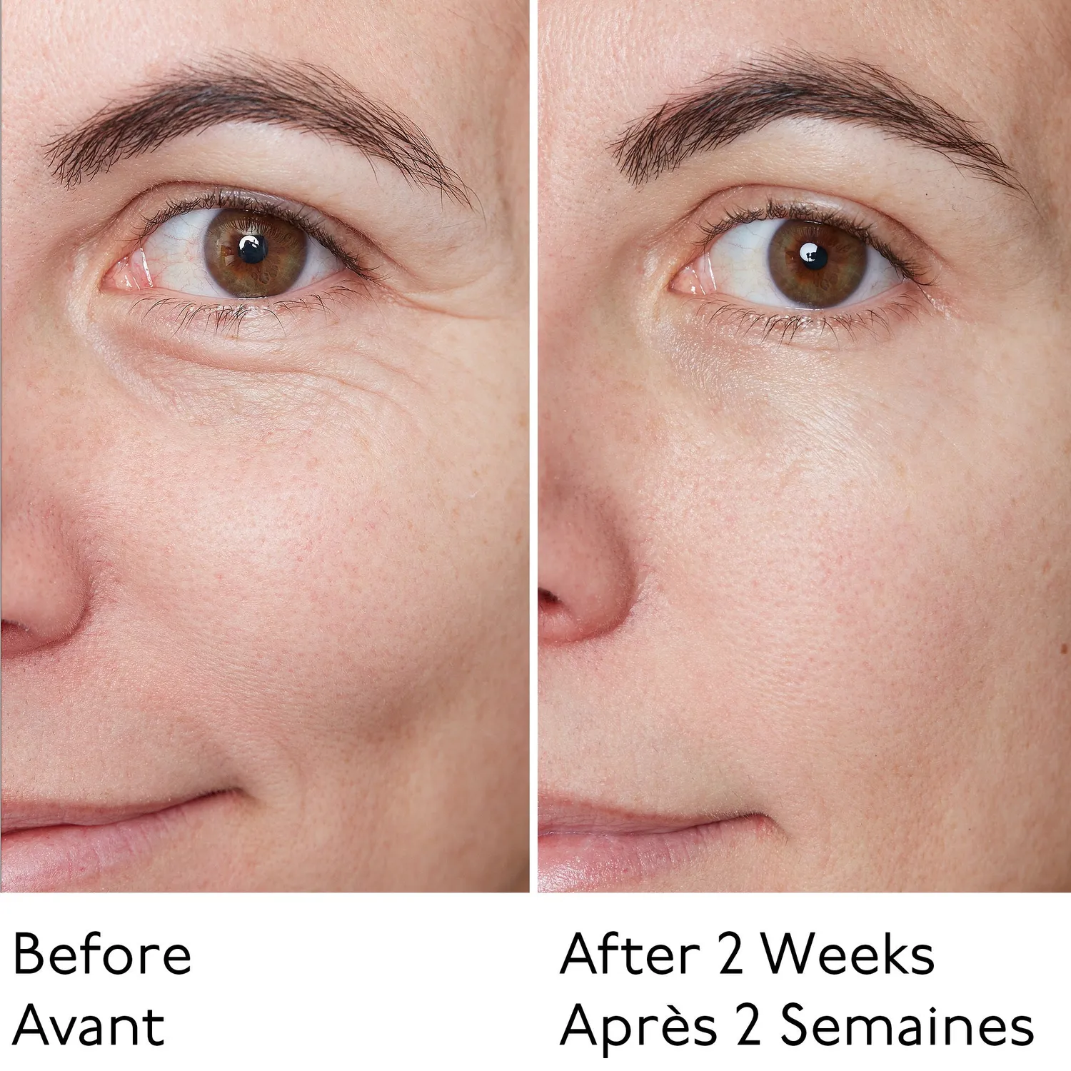 By Terry Hyaluronic Global Serum duo 2 sérums repulpant