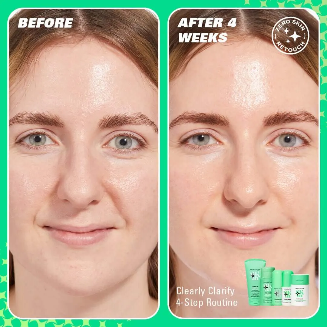 Revolution Skincare sérum acide salicylique niacinamide