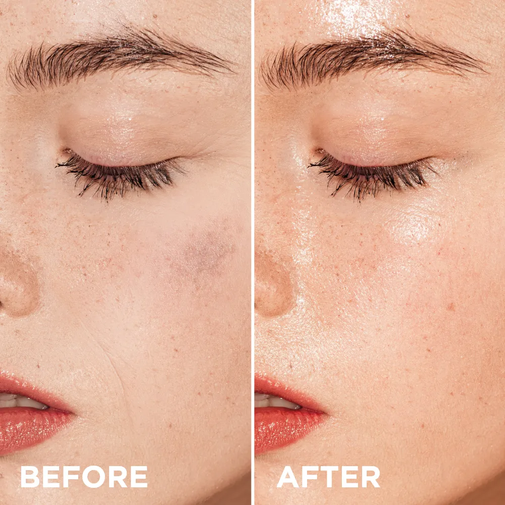 Eveline MesoNeedles sérum visage peptide rajeunissant