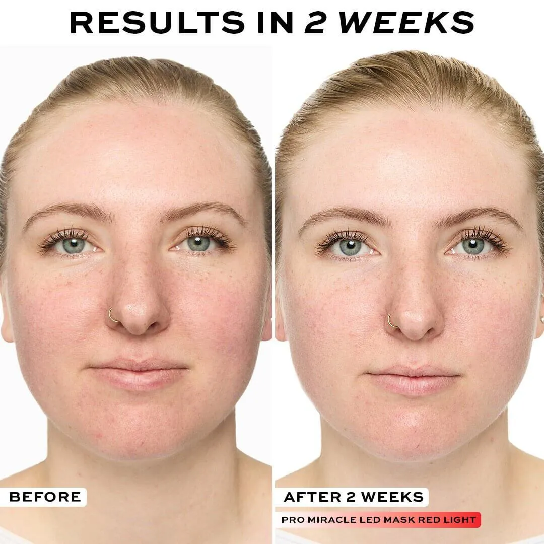 Revolution Pro Miracle LED masque visage 7 lumières