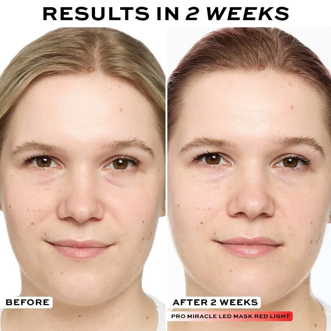 Revolution Pro Miracle LED masque visage 7 lumières