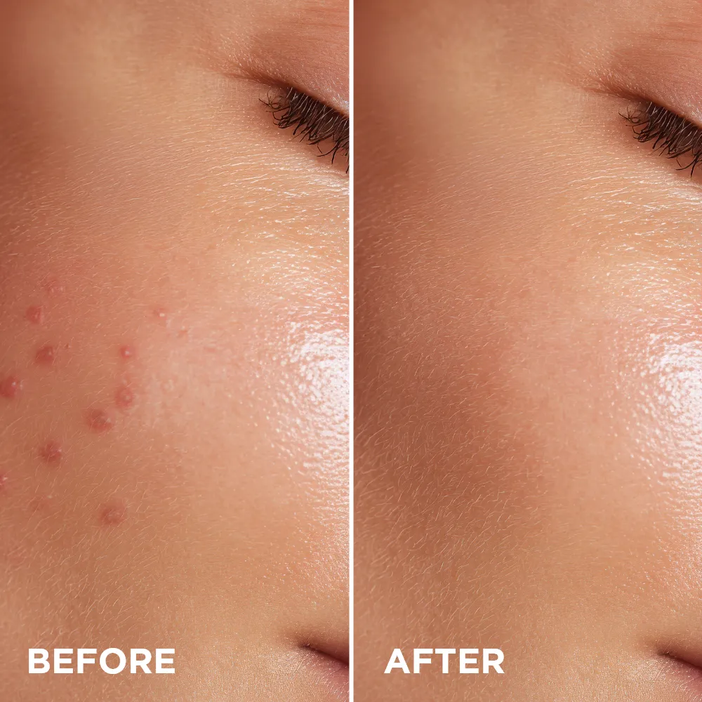 Eveline Super Duet sérum anti-imperfections zinc 10%