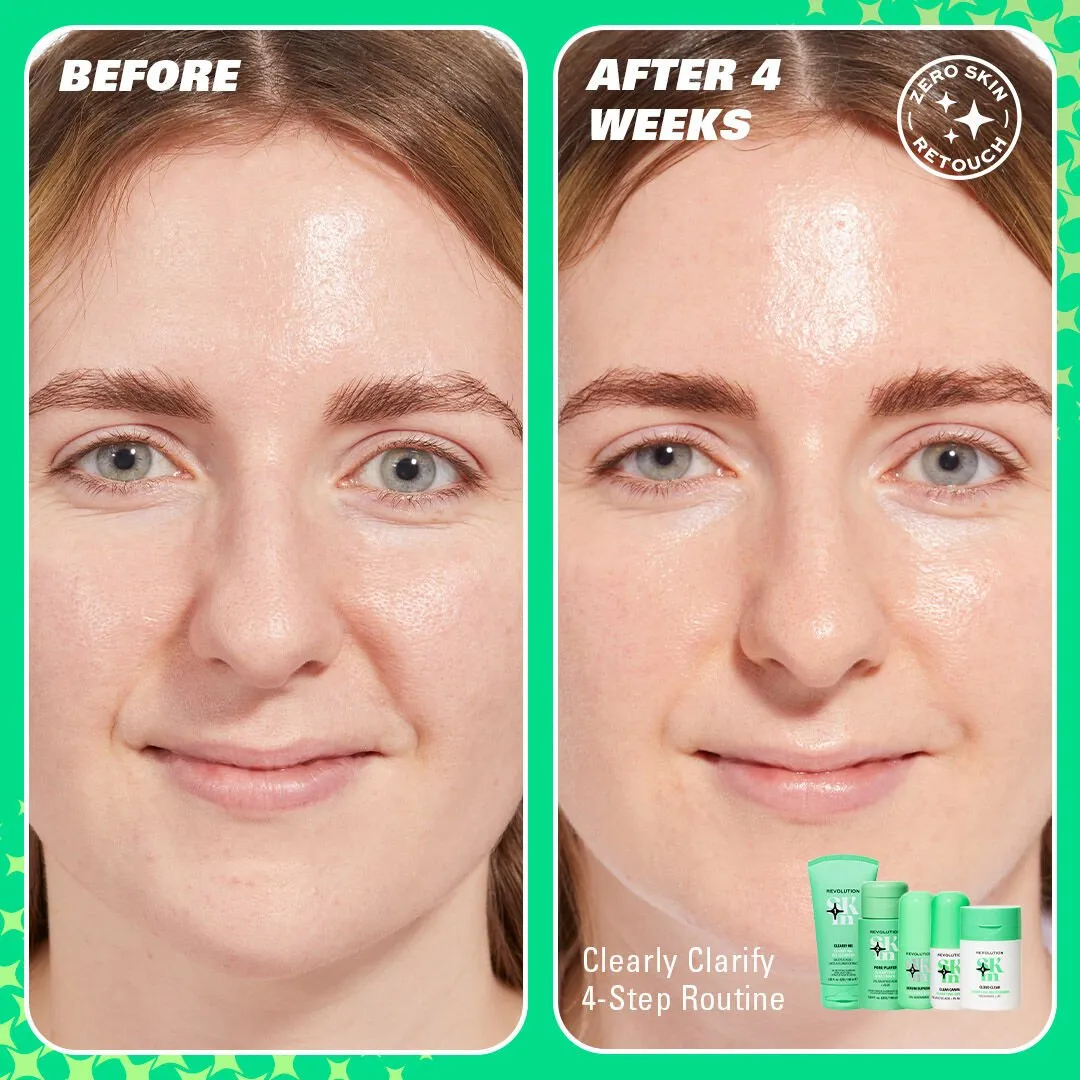 Revolution Skin Clear Canvas sérum 5% niacinamide imperfections